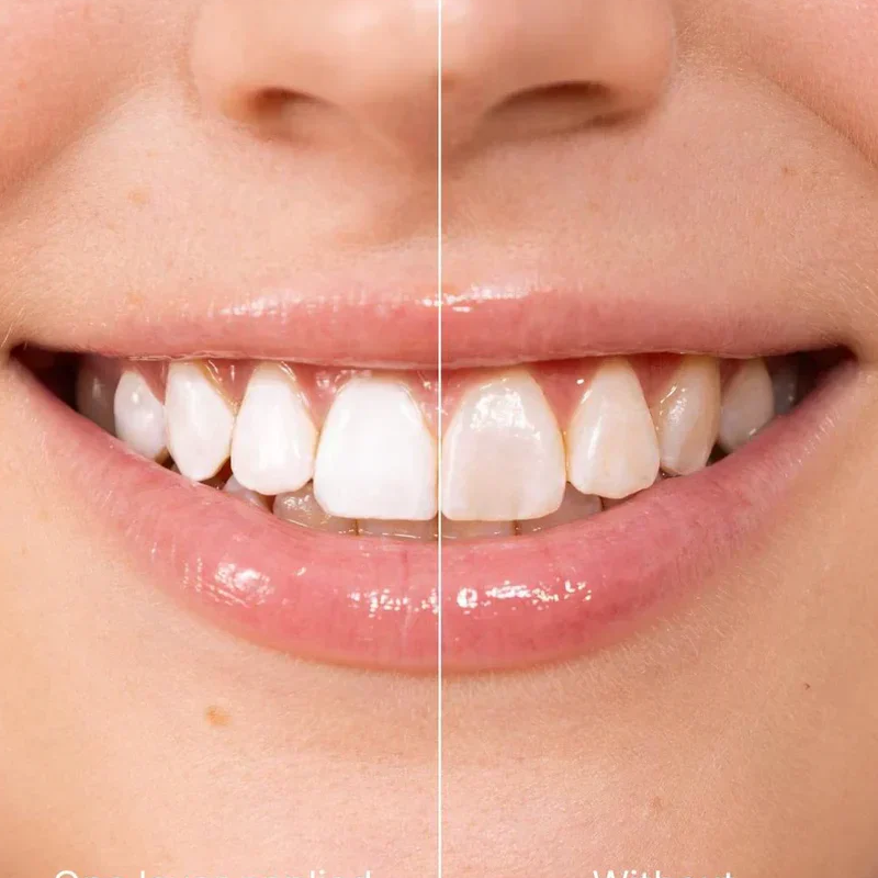⏳Spécial à durée limitée⏰Peinture dentaire blanchissante instantanée 5 ml🦷