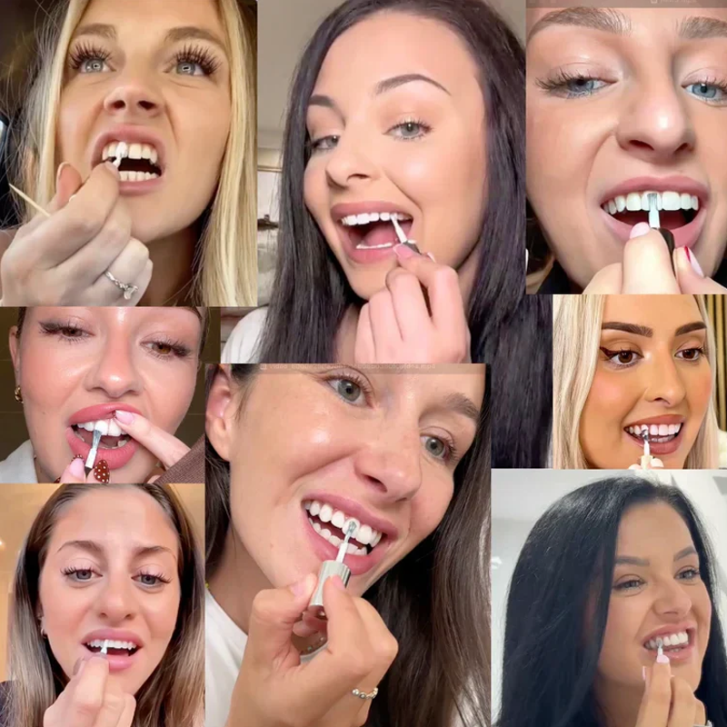 ⏳Spécial à durée limitée⏰Peinture dentaire blanchissante instantanée 5 ml🦷