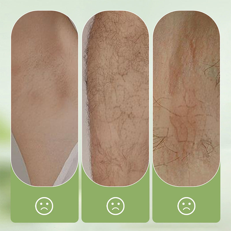 🏖️DERNIER JOUR DE SOLDE : 60 % DE RÉDUCTION⚡PLUS DE 50 000 EXEMPLAIRES VENDUS💕🎁Crème dépilatoire douce et non irritante