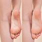 ⏳Offre limitée dans le temps : 50 % de réduction 💥Épilateur électrique pour les jambes